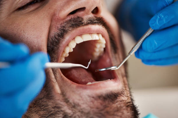 Best Oral Cancer Screening  in Kinsley, KS
